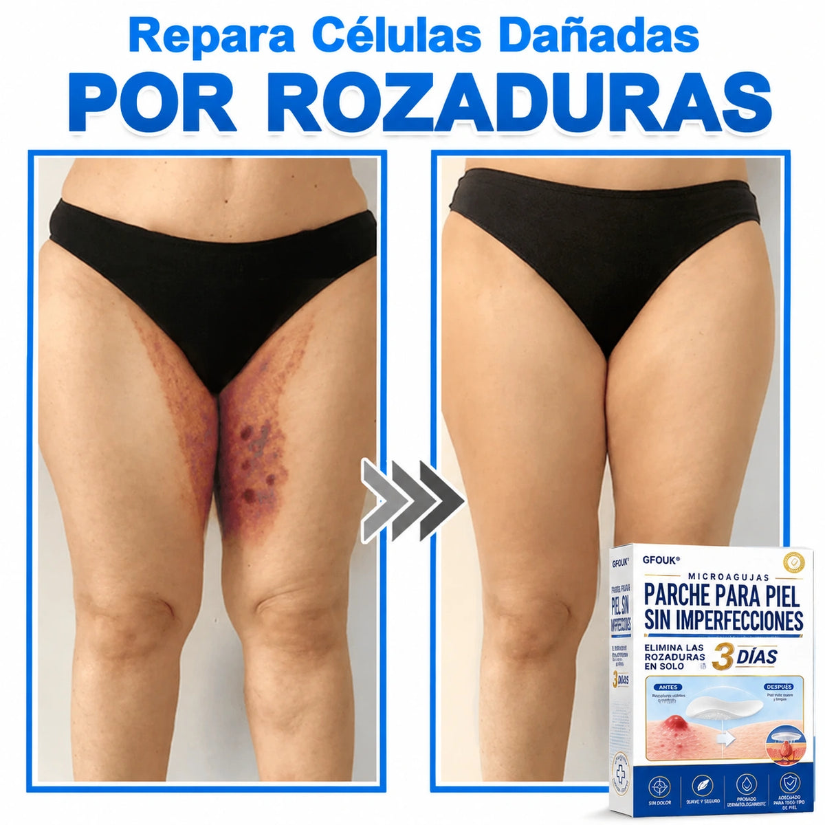 𝐆𝐅𝐎𝐔𝐊® 𝟐𝟎𝟐𝟔 𝐍𝐮𝐞𝐯𝐨𝐬 𝐏𝐚𝐫𝐜𝐡𝐞𝐬 𝐇𝐢𝐝𝐫𝐨𝐜𝐨𝐥𝐨𝐢𝐝𝐞𝐬 𝐝𝐞 𝐌𝐢𝐜𝐫𝐨𝐚𝐠𝐮𝐣𝐚𝐬 𝟐 𝐞𝐧 𝟏 | 𝐄𝐥𝐢𝐦𝐢𝐧𝐚 𝐥𝐮𝐧𝐚𝐫𝐞𝐬 𝐞𝐥𝐞𝐯𝐚𝐝𝐨𝐬, 𝐚𝐜𝐧é, 𝐯𝐞𝐫𝐫𝐮𝐠𝐚𝐬 𝐩𝐥𝐚𝐧𝐚𝐬 𝐲 𝐞𝐭𝐢𝐪𝐮𝐞𝐭𝐚𝐬 𝐜𝐮𝐭á𝐧𝐞𝐚𝐬 | 𝐌𝐞𝐣𝐨𝐫𝐚 𝐥𝐚 𝐚𝐩𝐚𝐫𝐢𝐞𝐧𝐜𝐢𝐚 𝐝𝐞 𝐚𝐫𝐫𝐮𝐠𝐚𝐬, 𝐜𝐢𝐜𝐚𝐭𝐫𝐢𝐜𝐞𝐬 𝐲 𝐦𝐚𝐧𝐜𝐡𝐚𝐬 𝐝𝐞 𝐥𝐚 𝐩𝐢𝐞𝐥 | 𝐏𝐚𝐫𝐜𝐡𝐞𝐬 𝐢𝐧𝐯𝐢𝐬𝐢𝐛𝐥𝐞𝐬 𝐩𝐚𝐫𝐚 𝐚𝐜𝐧é 𝐞𝐧 𝐜𝐚𝐫𝐚 𝐲 𝐜𝐮𝐞𝐫𝐩𝐨