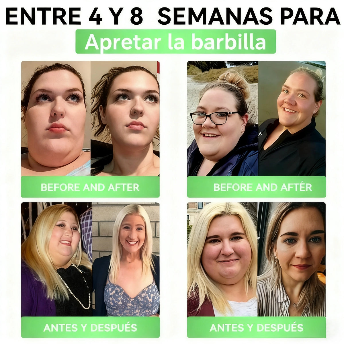 Cleansing® GLP-1 20 en 1 Suplemento Adelgazante (Resultados Visibles en 7 Días) ayuda a mejorar la obesidad, la salud cardiovascular, la diabetes, la salud intestinal, los problemas articulares, una piel más firme y un aumento de energía.